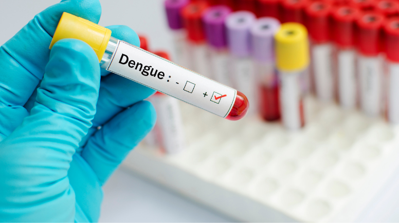 Dengue, Leptospirosis, and Other Febrile Illness